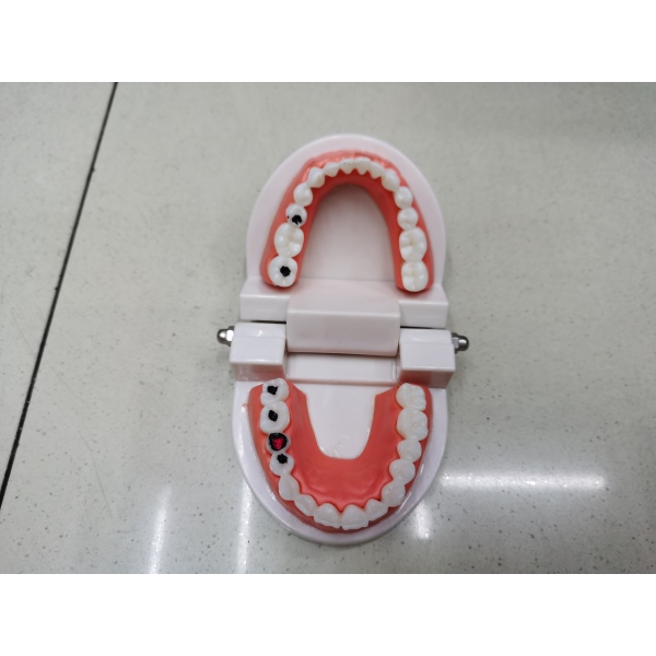 牙齿模型 塑料